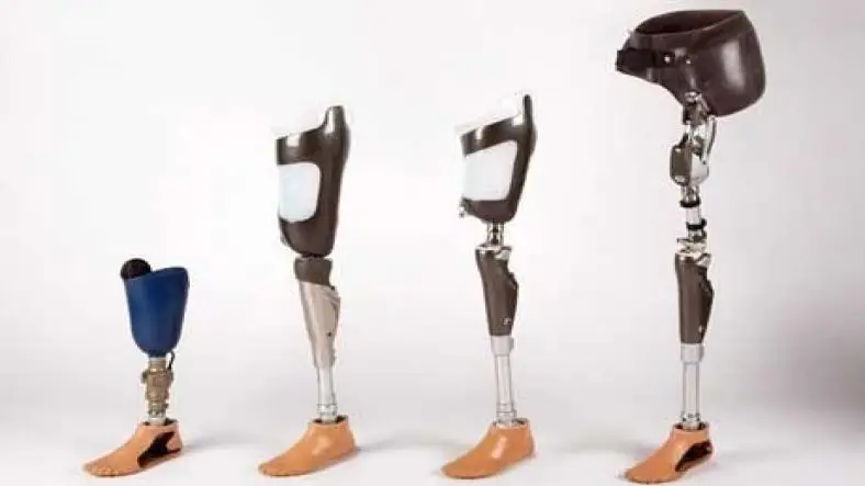 Advances in Prosthetic Limb Technology