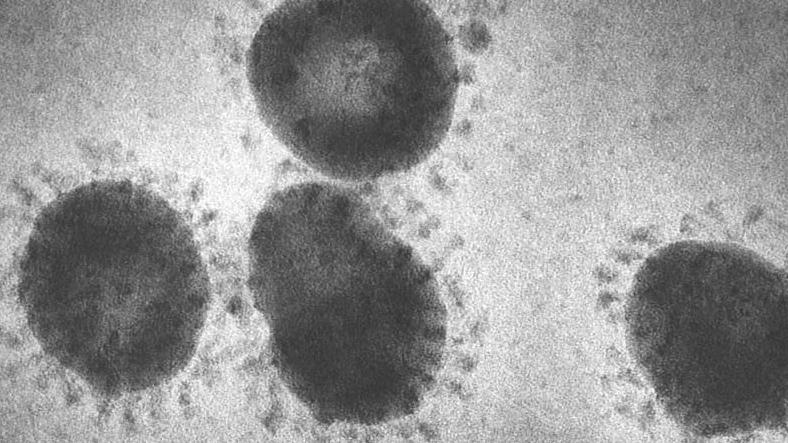 Coronavirus, Discovered in the 1960s, Serious Respiratory Tract Infections