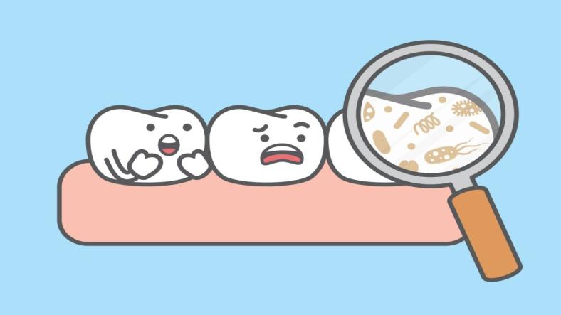 How to Avoid Dental Plaque Buildup