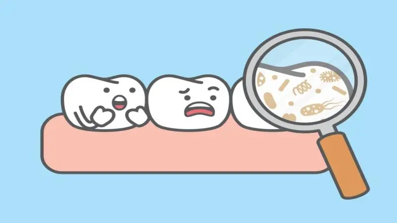 How to Avoid Dental Plaque Buildup