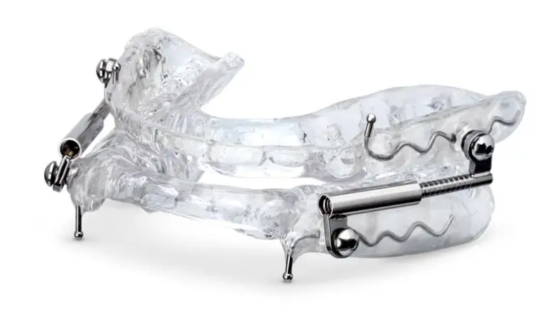 The Benefits of Custom-Fitted Dental Appliances