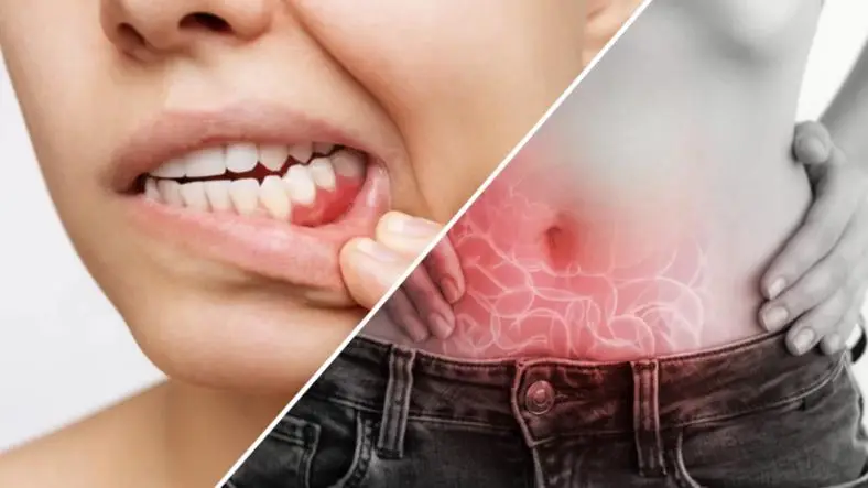 The Connection Between Oral Health and Digestive Health