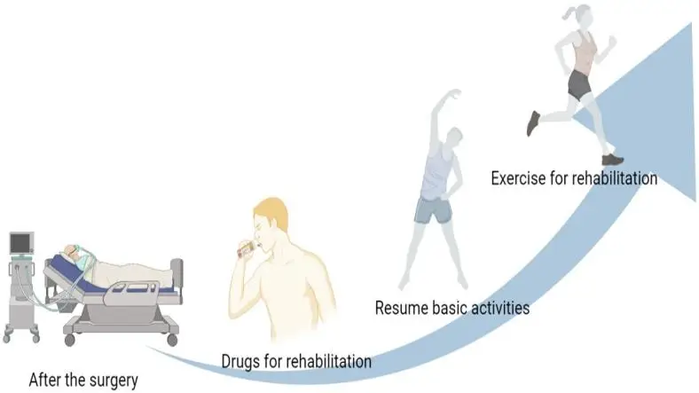 The Importance of Post-Surgical Rehabilitation Programs